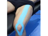 0-2142_1139_675_kinesiotape1.jpg